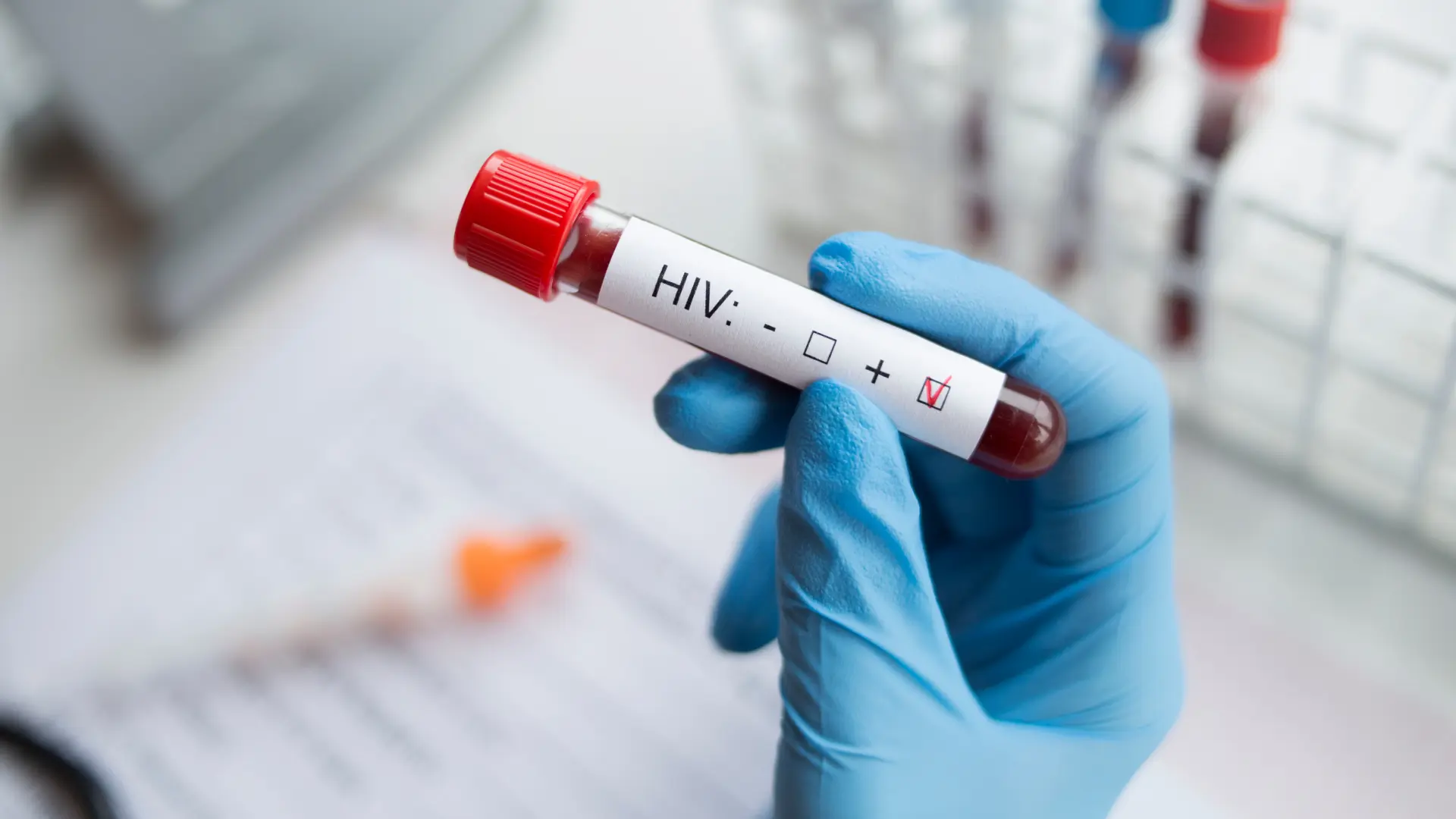 shutterstock_1224734254 Hiv, Virus, sida, terapija-6568b00de0ed1.webp