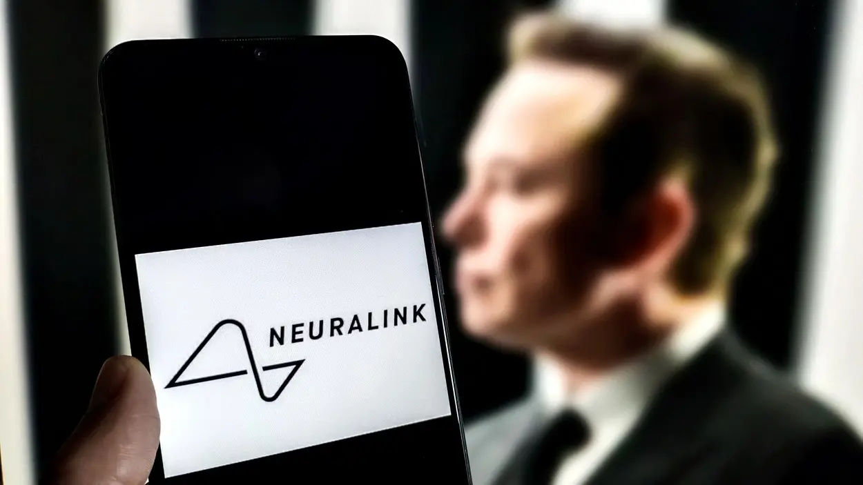 neuralink, ilon mask - 30 jan 2024 - profimedia-65b8a647e351a.webp