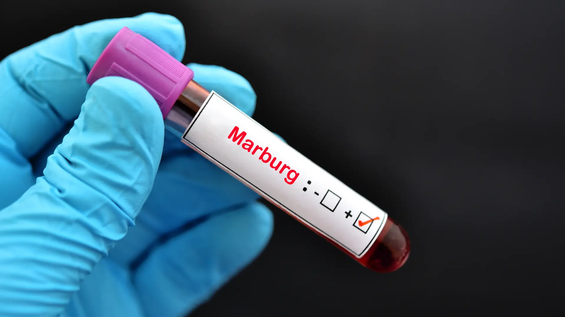 marburg virus shutterstock-66fec2d9e22c5.webp