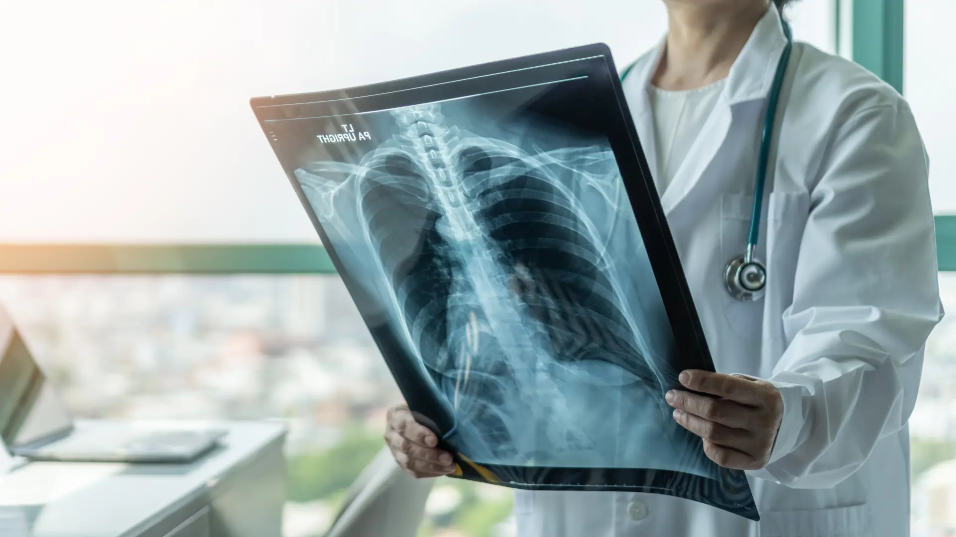 shutterstock pluća rentgen bolest doktor snimak ultrazvuk zračenje bolnica-67bb17c656bce.webp