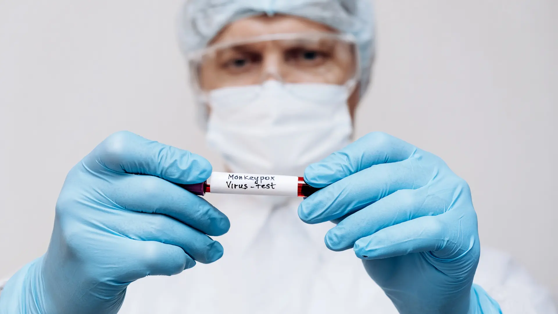 shutterstock_2159985719 majmunske boginje virus doktor lekar-68302ba586eed.webp