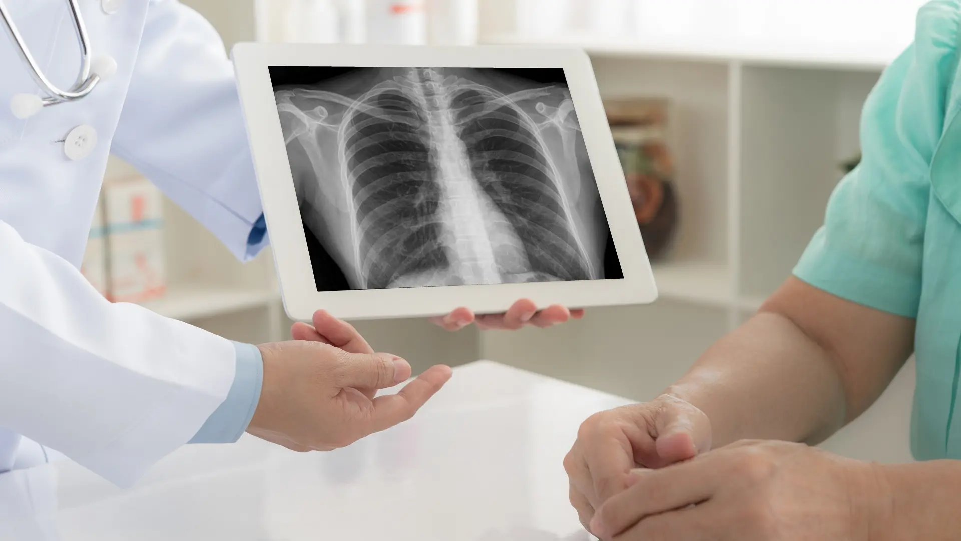 skrining raka pluća, rak pluća - shutterstock_1132301105-688b197866f90.webp