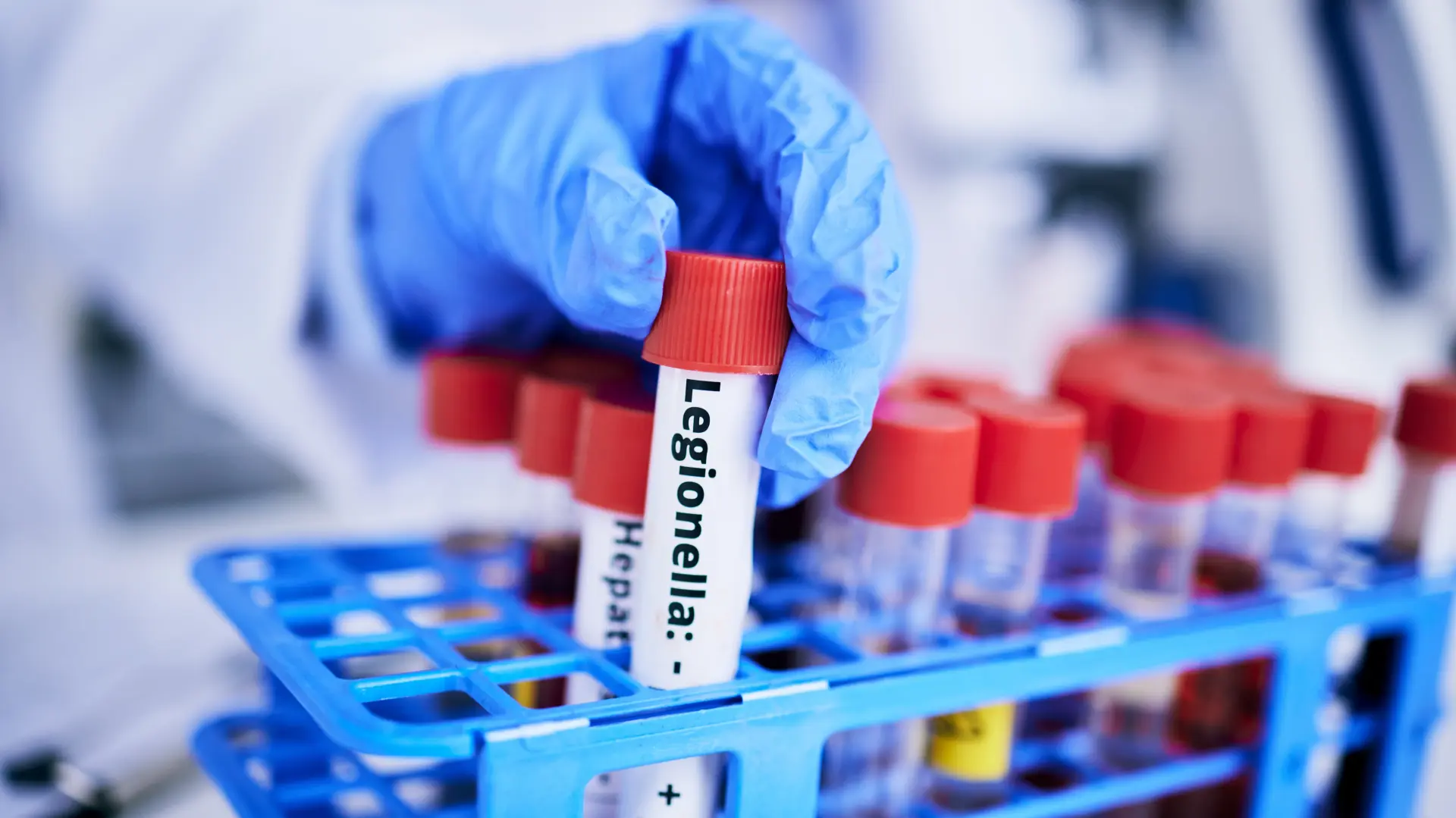 shutterstock_2325556021 legionarska bolest legionela bakterija-6933f23a43ed5.webp