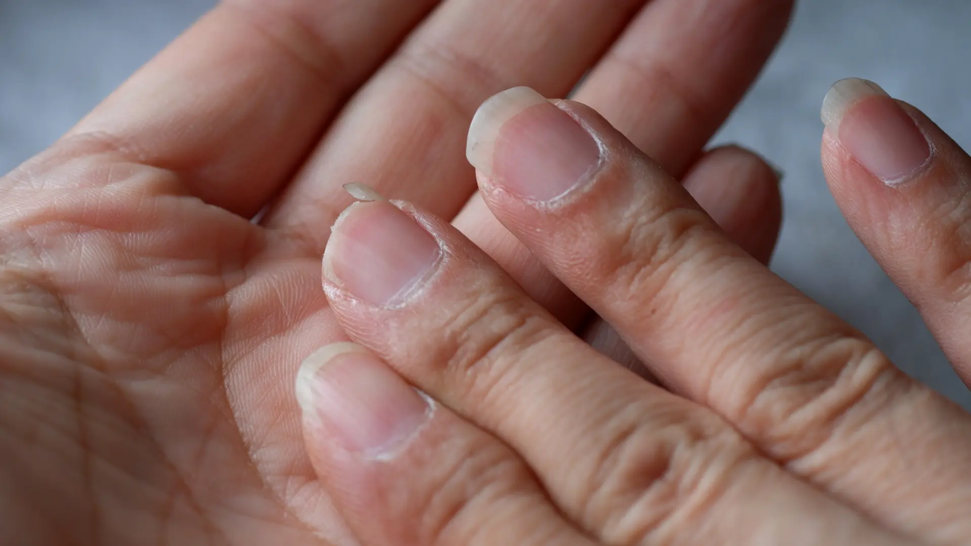shutterstock_2571489655 nokti prsti ruke ruka prst  zanoktica-6965f71307f32.webp