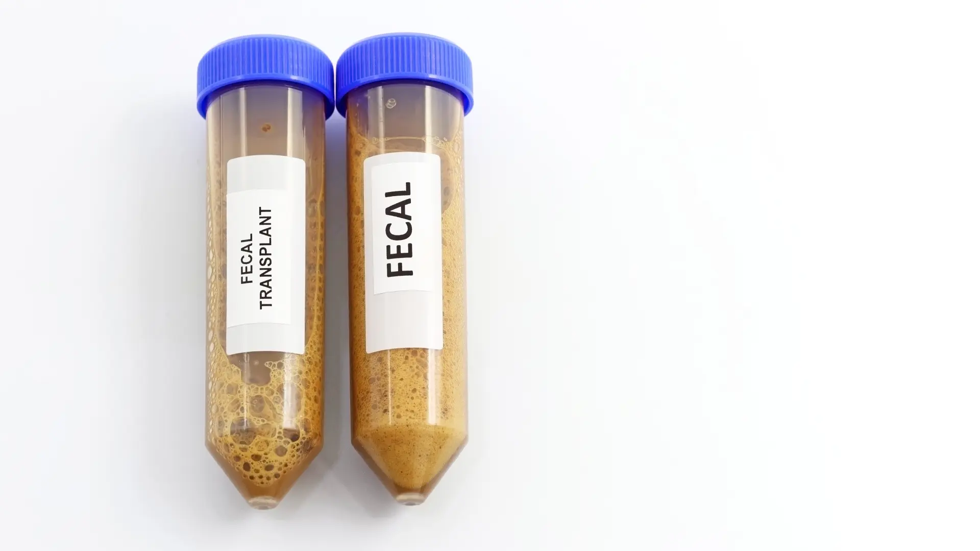 shutterstock_2322844683 fekalije izmet uzorak-6995d4901397d.webp