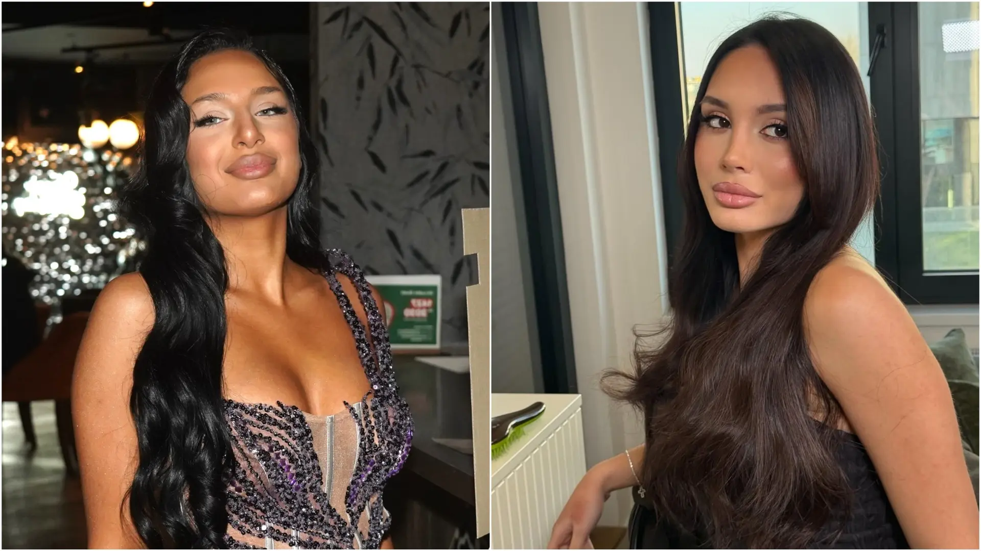 Antonio AhelATAImages, Instagram printscreen, nina_djoganiii nina đogani pre i posle operacija-69bd6c0470ef8.webp