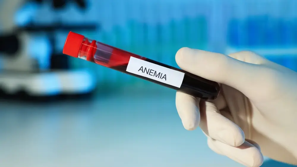 anemija, krv, epruveta, vađenje krvi-69abfcf1367c7.webp