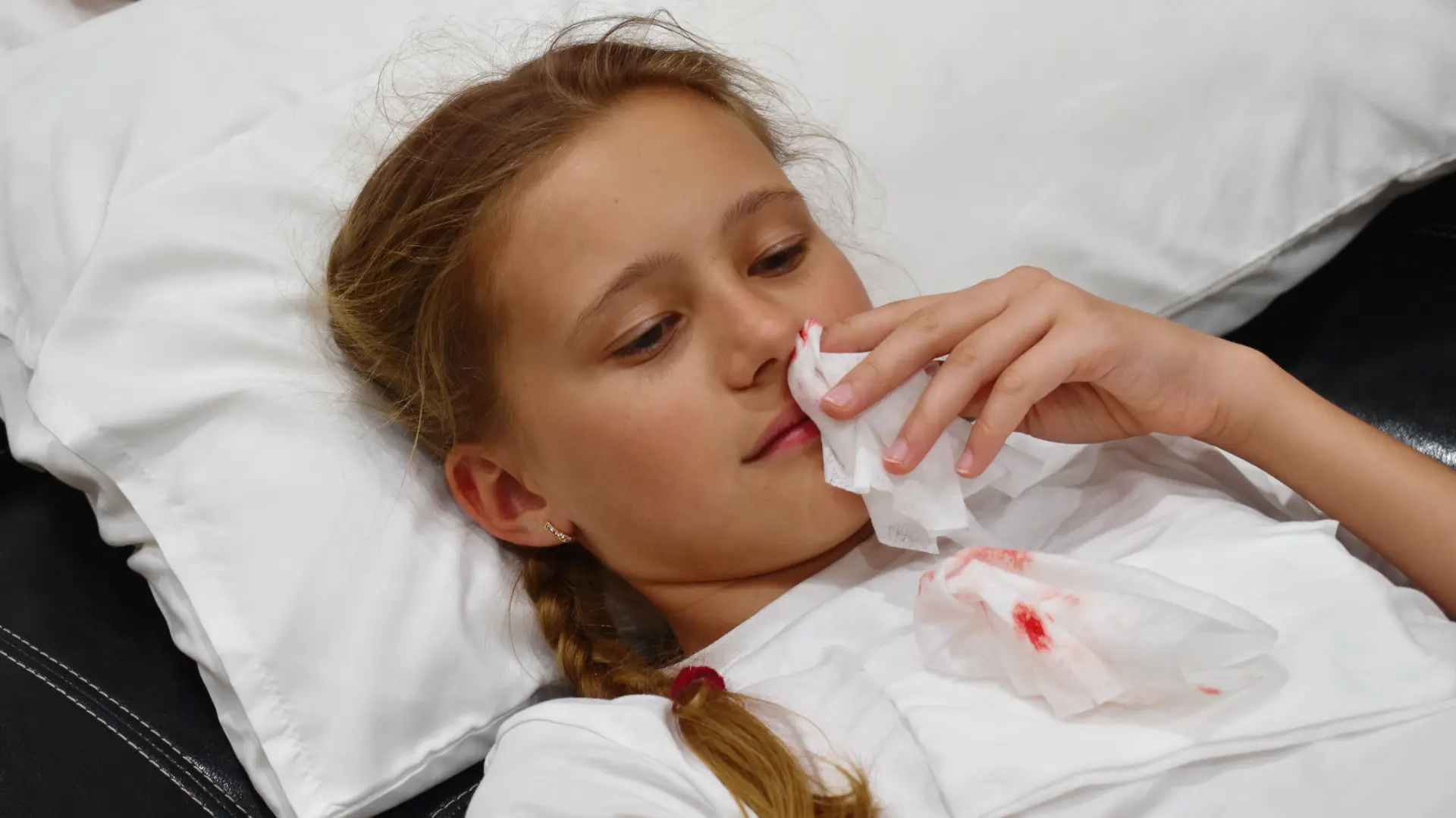 shutterstock_1620984685 krvarenje iz nosa devojčica-69c18023c1277.webp