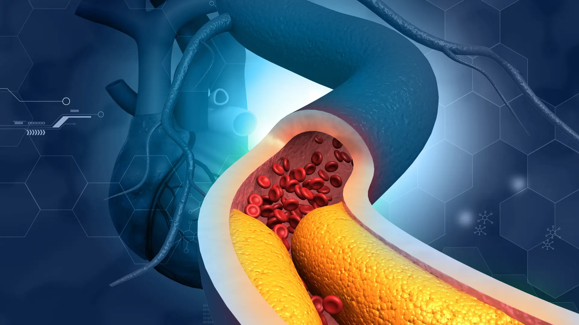 shutterstock_2340104611 ateroskleroza arterije  krvna zrnca holesterol-69c2aee703560.webp