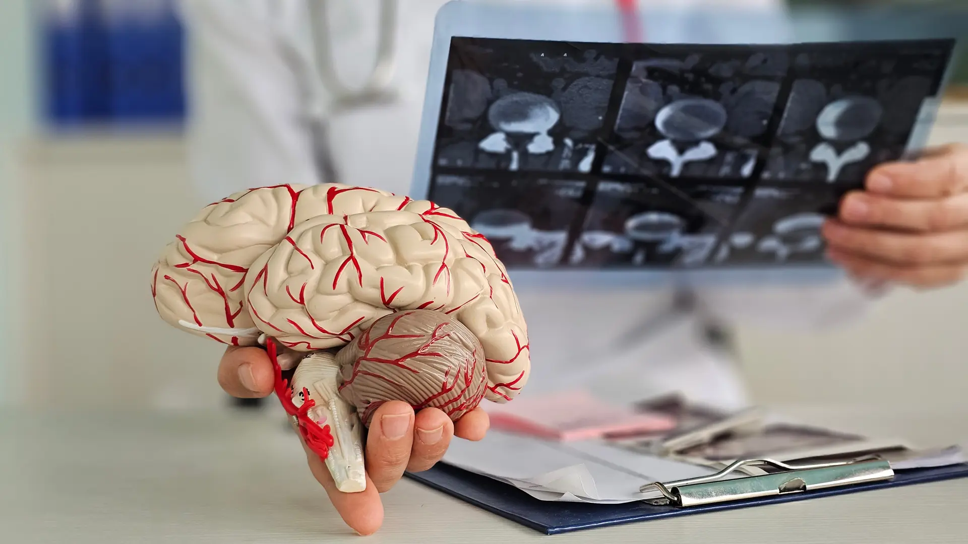 shutterstock_2535188465 mozak  glava nervi doktor brain-69beb41d0576b.webp