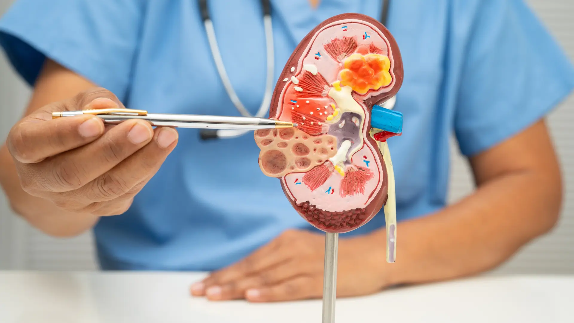 shutterstock_2736478279 bubrezi bubreg doktor  kamen u bubregu-69b2cb981e834.webp