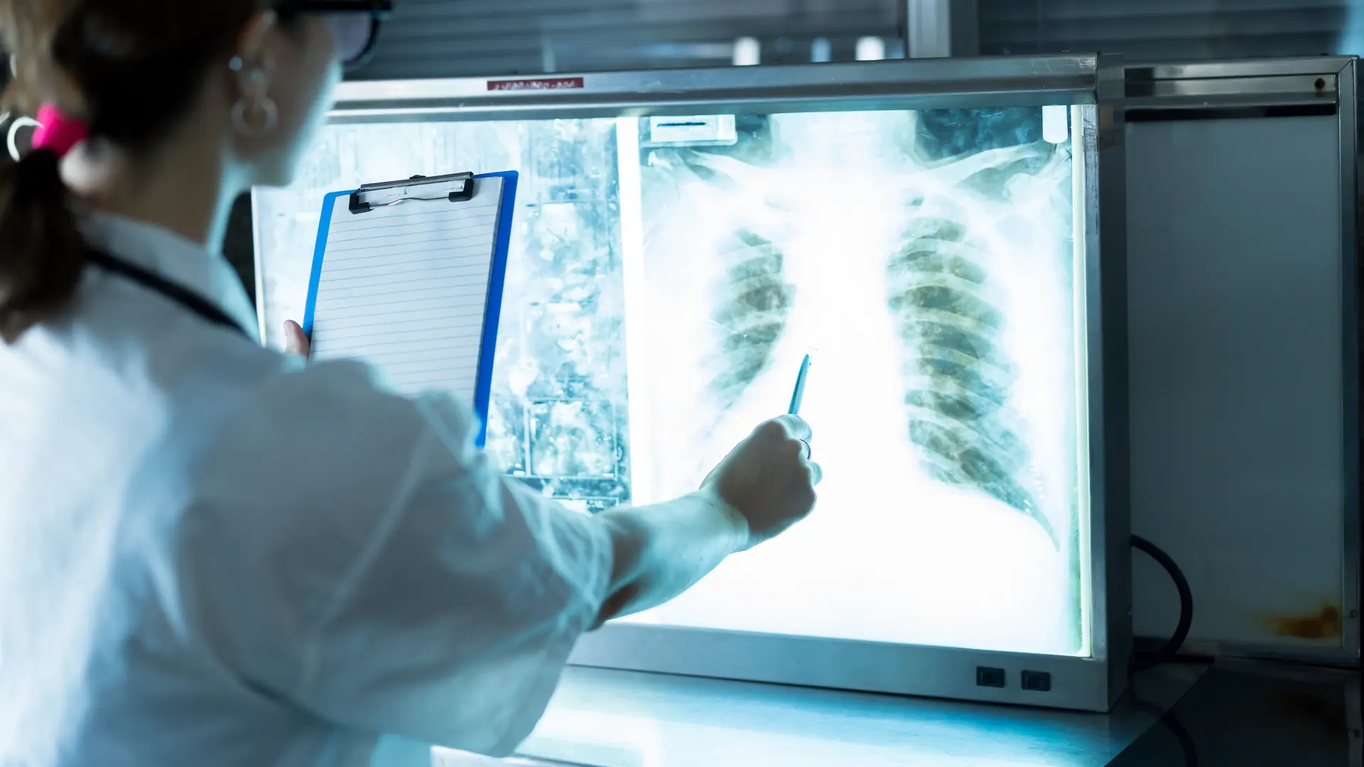 shutterstock_2204918207 transplatacija pluća-69db984f4257f.webp