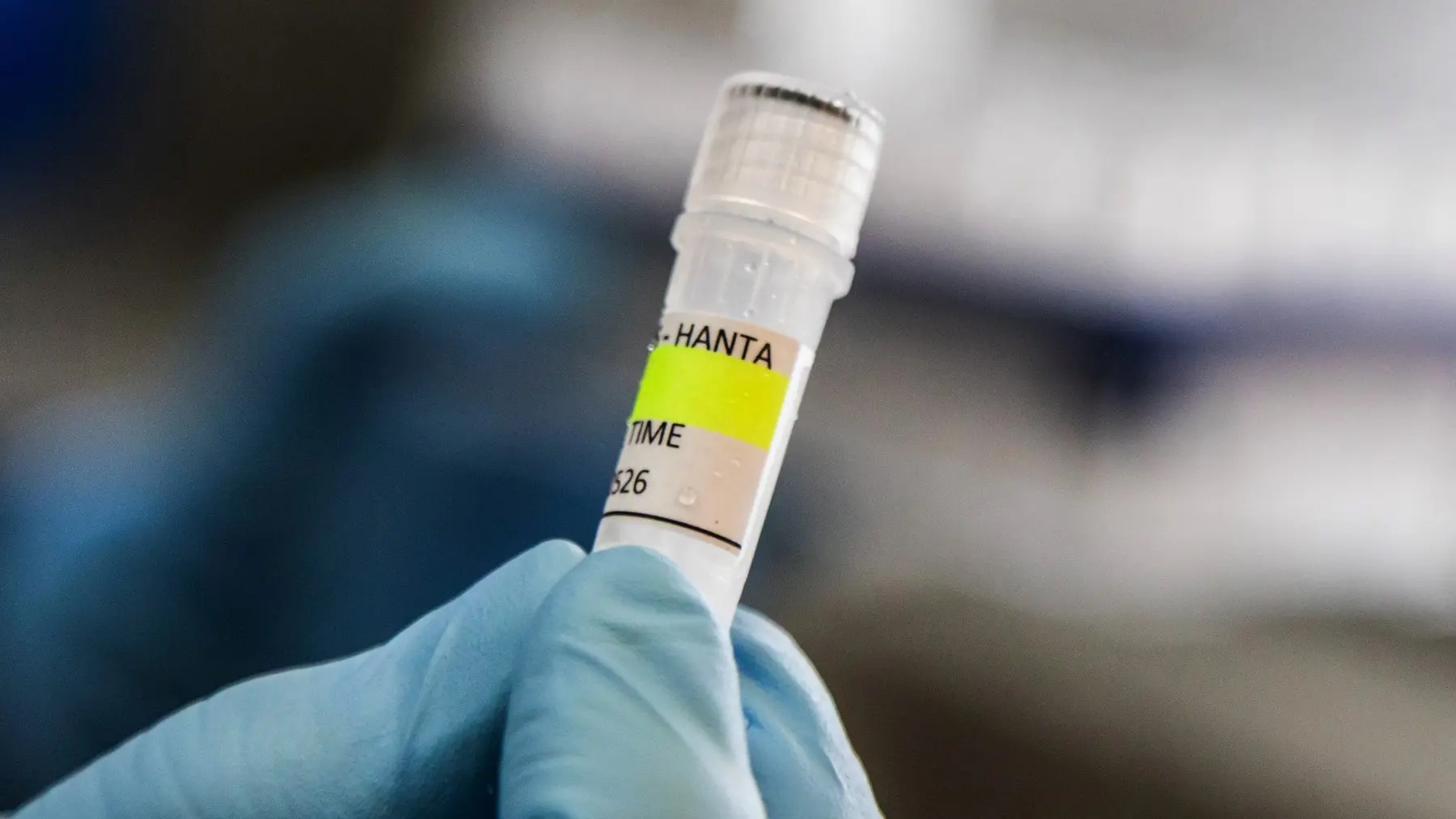 hantavirus profimedia-1096967321-69fc3a7c34e62.webp