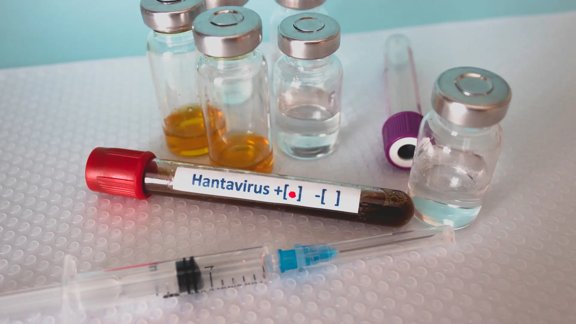 shutterstock_1682612782 Orthohantavirus hanta virus hantavirus-69fb46fcb5810.webp