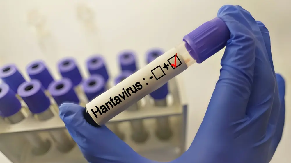 shutterstock_2494389449. hantavirus, virus,jpg-69fa0e98f2271.webp