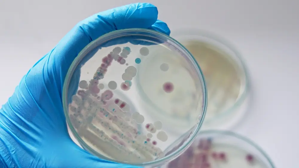 shutterstock_2087779312 bakterija, laboratorija, testovi, testiranje-6a3c0d1e25b99.webp