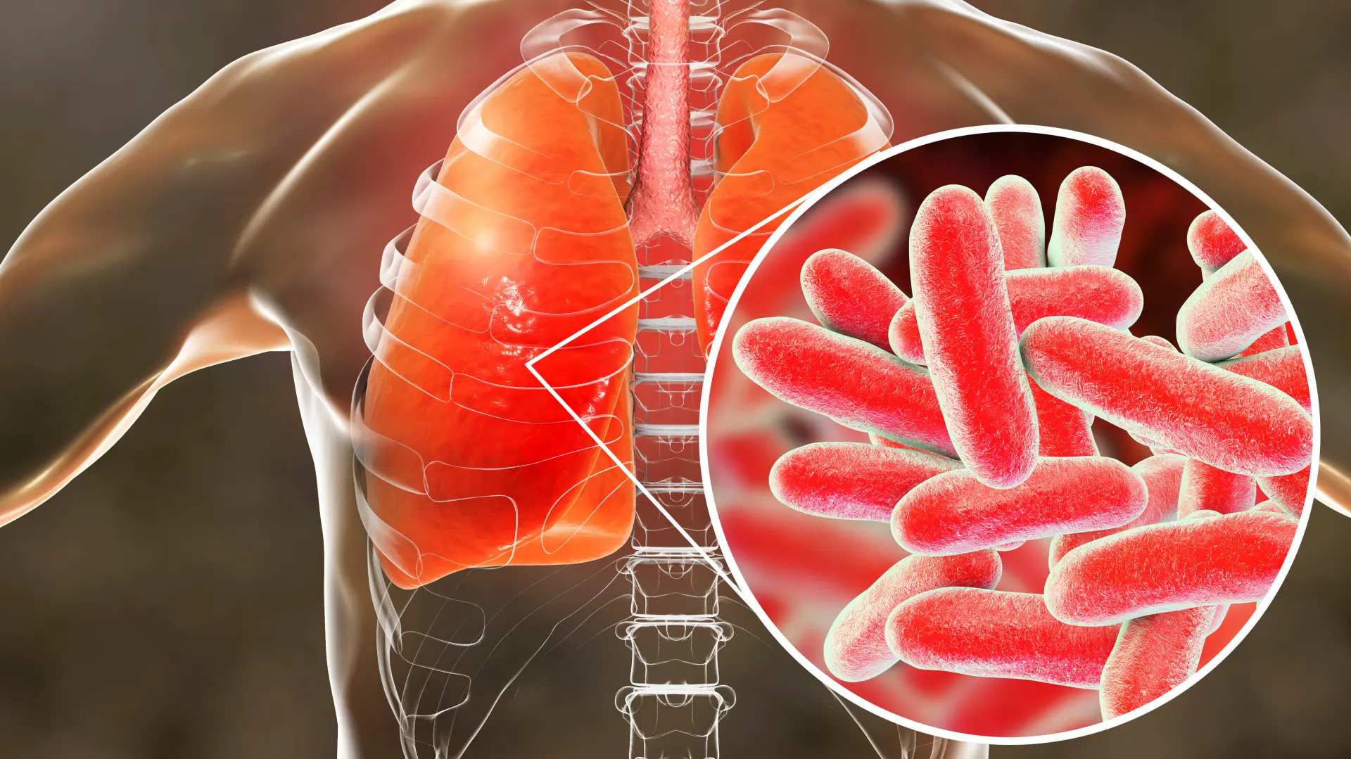 shutterstock_1053861413 bakterija virus pluća-6a5e252885c4c.webp