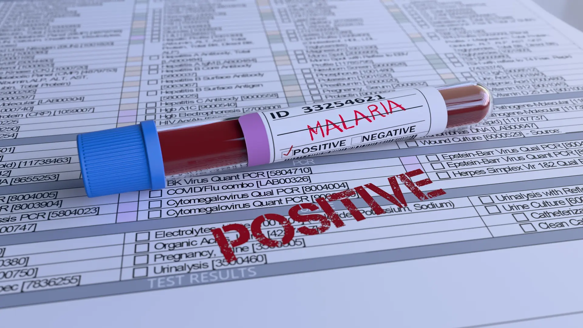 shutterstock_2776545537 malarija malaria zaraza-6a5b7d41835cd.webp