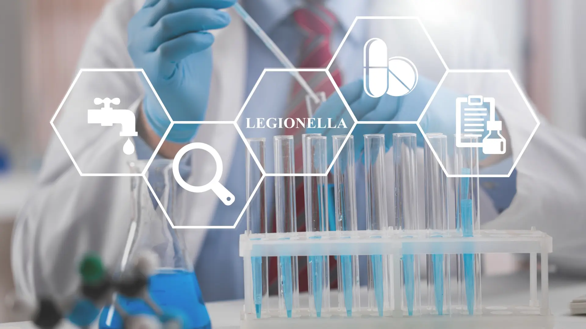 shutterstock_2177157317 legionella legionela-6ab2756c6c222.webp