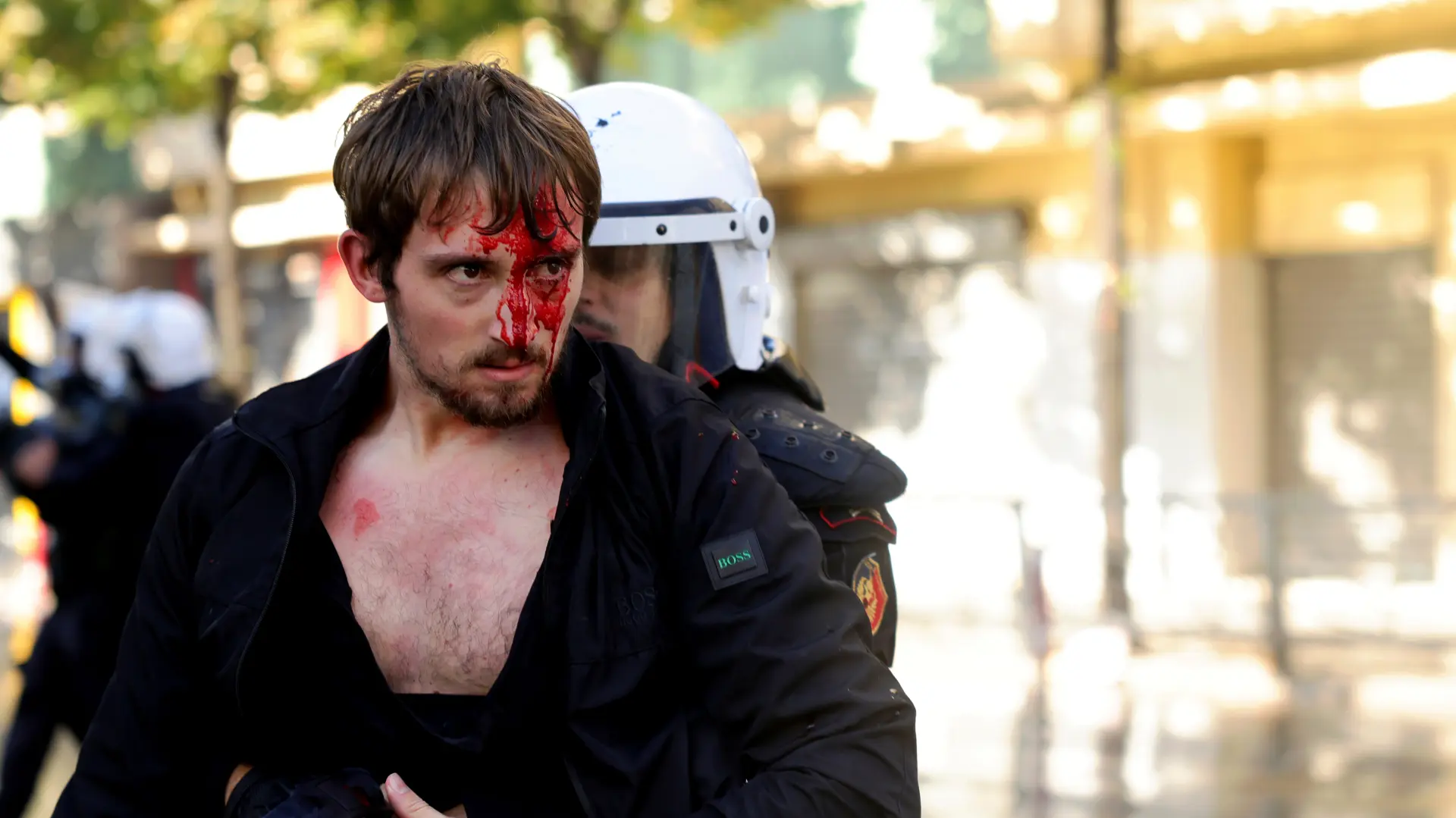 protesti u albaniji AP PhotoHameraldi Agolli-6ad2422819303.webp